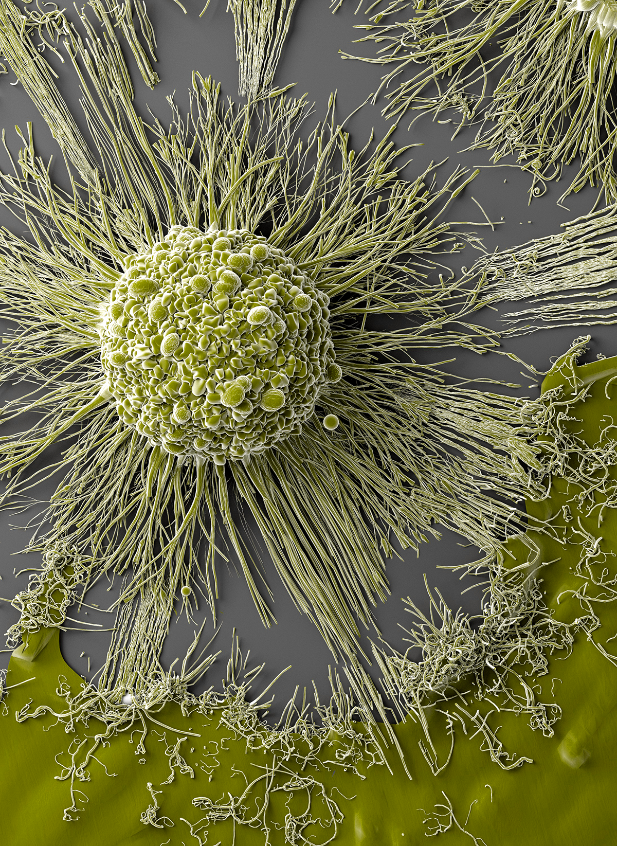 Cancer Cell Division on Behance45256b77860021.5c93c1e5e82f5.png